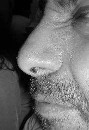 Nose