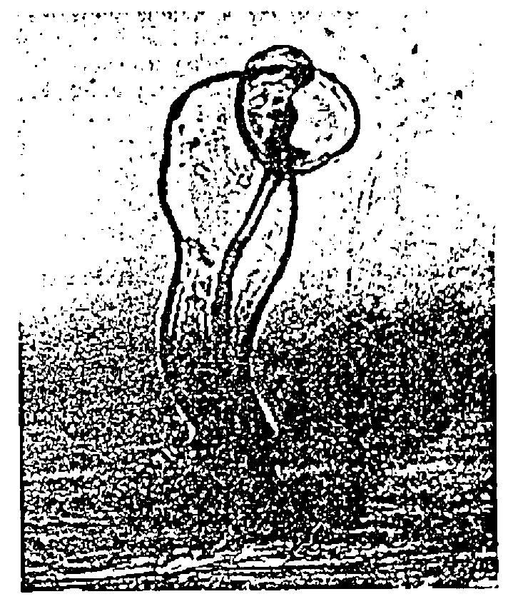 A micrograph of a root hair curled over at the top into a hook, with a thread running down its centre
